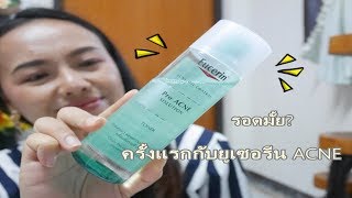 ต้องรีวิว EP177 Eucerin Pro ACNE Solution ควรจะตำดีมั้ย ลดสิวได้มั้ย [upl. by Derfniw]