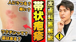 【3人に1人が発症？】帯状疱疹の原因・症状・治療法・ワクチンについて皮膚科専門医が解説【人にうつる？】 [upl. by Jacynth]