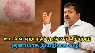 உடலில் ஏற்படும் பூஞ்சை தொற்று குணமாக இயற்கை வைத்தியம்DrSivaraman speech on fungal infection remedy [upl. by Lam423]