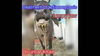 treatment of actinomycosis l symptoms of actinomycosis l dr umar khan [upl. by Irdua]