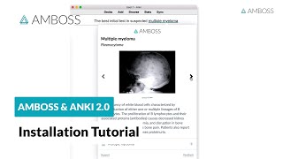 Installation Tutorial Anki x AMBOSS Addon [upl. by Kenzie61]