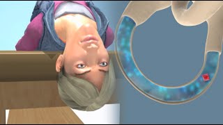 Deep Head Hanging Maneuver to Treat BPPV Vertigo [upl. by Enaasiali68]