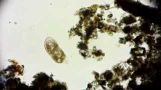 Stylonychia Wimpertierchen  Ciliate  Ciliophora  Ciliata  microorganisms under microscope [upl. by Farkas]