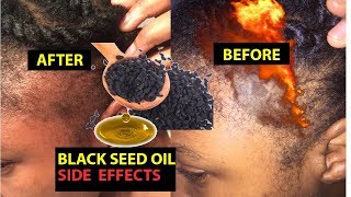 How to Use Black Seed Oil for Hair Growth And Prevent Hair Fall [upl. by Watson]