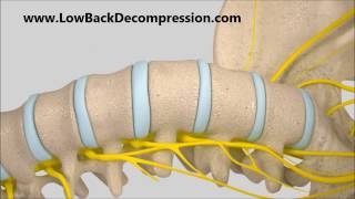 Horizontal Back Decompression System for Home Use [upl. by Laden]