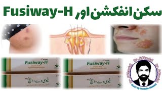 FusiwayH Cream  FusiwayH Best in Skin Infection  DrAHMandal Urdu  Hindi [upl. by Clarkson959]