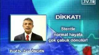 Stent takıldıktan ne kadar zaman sonra normal hayata dönülür [upl. by Hun]