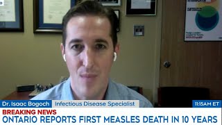 Measles in Ontario Are more outbreaks possible [upl. by Haliled]