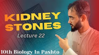 Kidney Stones  Disorder of Kidneys  How to Treat the kidney stones  Lecture 22 [upl. by Ayota]