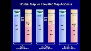 ABG Interpretation The Anion Gap Lesson 5 [upl. by Mccarty]