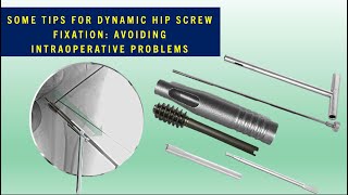 Basic tips for Dynamic Hip ScrewSliding Hip ScrewDHSSHS fixation Avoid intraoperative struggle [upl. by Strander]