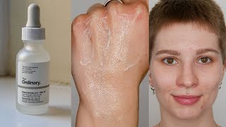 The Ordinary Niacinamide Foaming  Am I applying it Wrong What you need to know Soapiness [upl. by Bunny91]