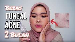 Skincare Routine Jerawat dan Fungal Acne [upl. by Neellok]