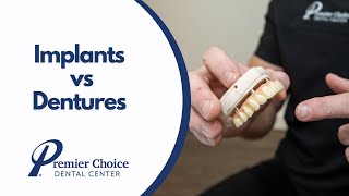 Implants vs Dentures Whats Best For You [upl. by Bonine]