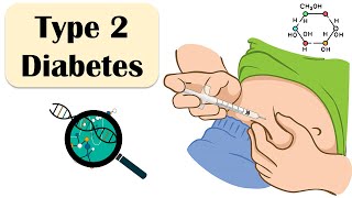 Type 2 Diabetes  Causes Risk Factors Signs amp Symptoms Treatment  Everything You Need To Know [upl. by Nobel]