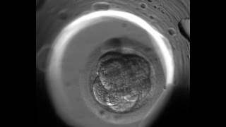 EmbryoScope  New IVF Technology [upl. by Friedrich]