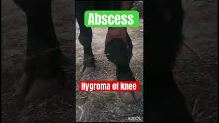 Hygroma of knee l Dr Umar Khan [upl. by Tegdirb320]