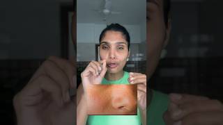 Bumps ke liye yeh toner use karo 2 times a week and see the change [upl. by Maribel]