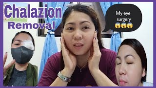 CHALAZION REMOVAL  EYE SURGERY  MY EXPERIENCE  Lanz PurpleGoddess [upl. by Goines]