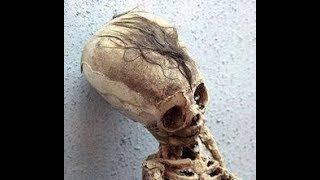 FINALLY DNA Results Of The Paracas Elongated Skulls Of Peru Part 1 [upl. by Yeleek579]