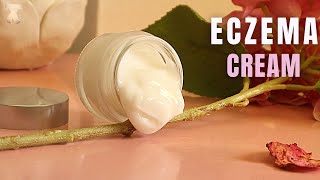 Homemade Body Cream For Eczema Itchy Skin Relief [upl. by Airitak]