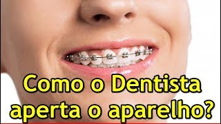 Como o Dentista aperta o aparelho fixo [upl. by Mcgaw515]