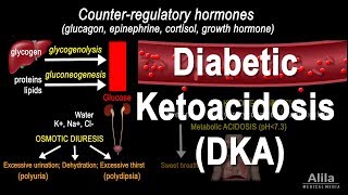 Diabetic Ketoacidosis DKA Pathophysiology Animation [upl. by Naes167]