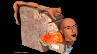 Primary Motor Cortex  Neuroanatomy [upl. by Suiradel]