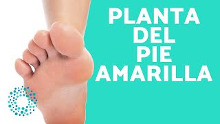 ¿Por qué tengo la PLANTA del PIE AMARILLA [upl. by Anuahsed]