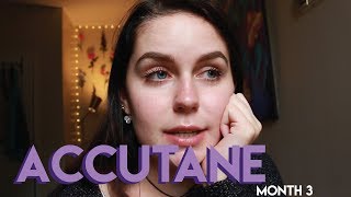 my third month on Accutane [upl. by Nyleahs479]