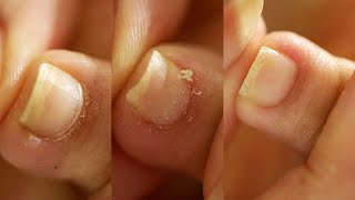 AT HOME PEDICURE  Detailed Cuticle Work [upl. by Glanville]