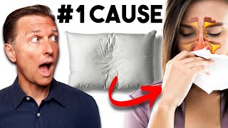 The Cause of Your Sinus Stuffiness Congestion Is Hiding in Your Pillow [upl. by Eesyak]