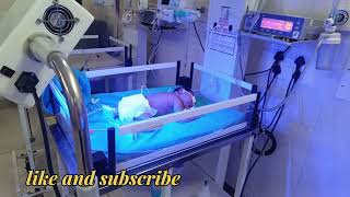 New born baby neonatal jaundice phototherapy [upl. by Wulfe343]