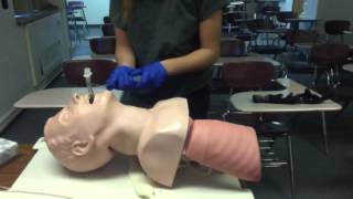 Extubation procedure [upl. by Llerihs351]