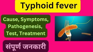 Typhoid fever cause symptoms Test pathogenesis Treatment  Baptisia q [upl. by Kile]