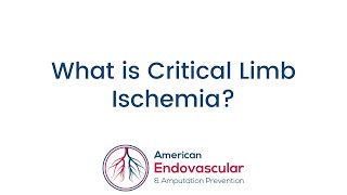 What is Critical Limb Ischemia [upl. by Mozelle563]