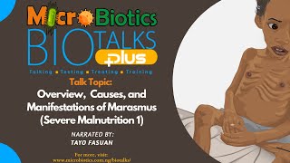 Overview Causes and Manifestations of Marasmus Severe Malnutrition 1 [upl. by Aprilette112]