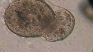 Paramecium Succumbs to Exposure of Low Strength Colloidal Silver [upl. by Osbert]