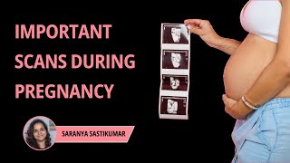 4 Important Scans During Pregnany  Ultrasound Scans During Pregnancy [upl. by Tychonn]