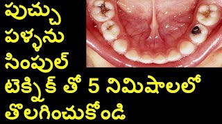 How To Solve Tooth Decay  Natural Remedies  Health Tips  Movie Reviews [upl. by Nesline336]