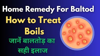 Baltod Ka Ilaj  How to Treat Boils  Home Remedy For Baltod [upl. by Hope]