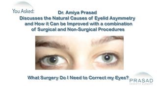 How Eyelid Asymmetry can be Addressed by Combining Surgical and NonSurgical Procedures [upl. by Oremoh512]