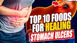 Top 10 Foods to Heal Your Stomach Ulcer Naturally [upl. by Roseanne291]