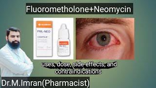 FML NEO eye drops are used in urdu  eye drops  Medicine information [upl. by Harmony]