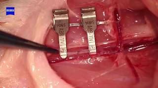 Supermicrosurgery 06mm Rat Saphenous Artery Ananstomosis [upl. by Novahs]