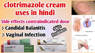 clotrimazole cream lp 1 ww uses side effects contraindicated dose in hindi candid B candid Gold [upl. by Anelaj]