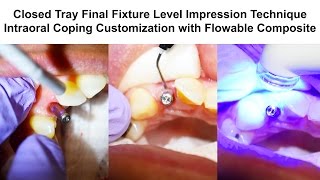 8b Implants Impression Coping Customization with Flowable Composite [upl. by Nema]