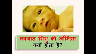 Neonatal Jaundice l Polio l causes l symptoms l treatment l ayurveda [upl. by Ylenats]