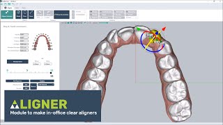 Clear aligner software thermoforming or direct printing [upl. by Wash106]