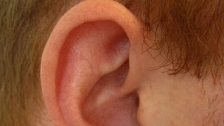 Determine If Ear Cartilage Is Infected  Ear Problems [upl. by Hna321]